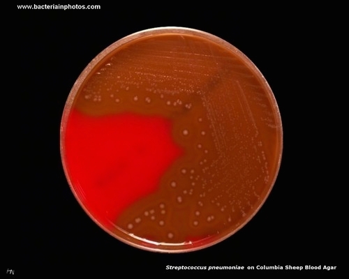 pneumococcus on columbia blood agar